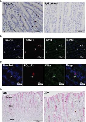 Tuft Cells Increase Following Ovine Intestinal Parasite Infections and Define Evolutionarily Conserved and Divergent Responses